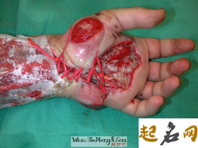 梦见自己手背流血是什么意思【好不好】 梦见蛇咬手背是什么意思