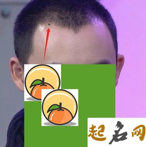 发际线上有痣的男人好不好？ 发际线正中间长痣代表