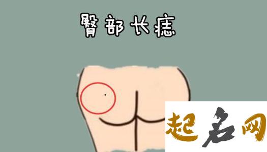 屁股上有痣代表什么？关于屁股上有痣的传说 屁股有痣的男人的命运