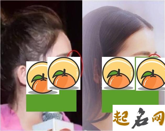 鼻梁尖削露骨的女性会非常的穷吗？为什么？ 鼻梁塌怎么办