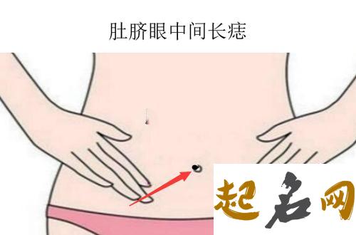 肚脐正中有痣代表什么 女人肚脐眼正下方有痣