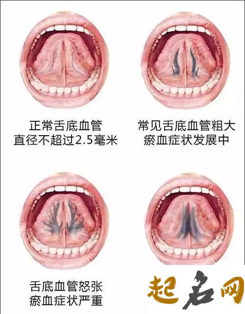 从舌头看疾病与健康 正常舌头是什么样的