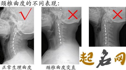 长流水命遇上反弓路该如何化解？ 颈椎反弓是什么意思