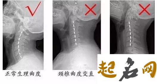 详细分析反弓路的风水格局 颈椎反弓是什么意思