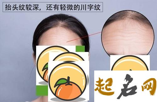 额上纹好不好？ 额头上川字纹越来越深