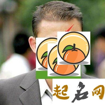 太阳穴长竖纹，对运势影响如何？ 额头竖纹