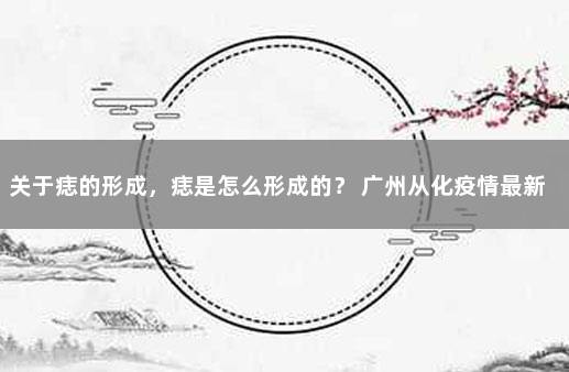 关于痣的形成，痣是怎么形成的？ 广州从化疫情最新数据消息